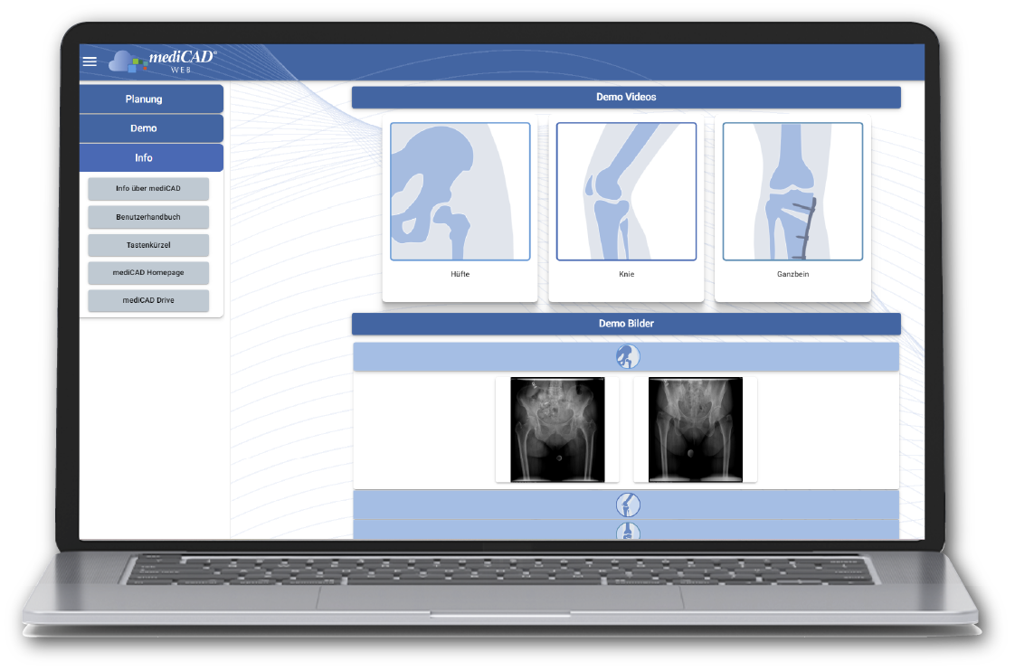 Web mediCAD