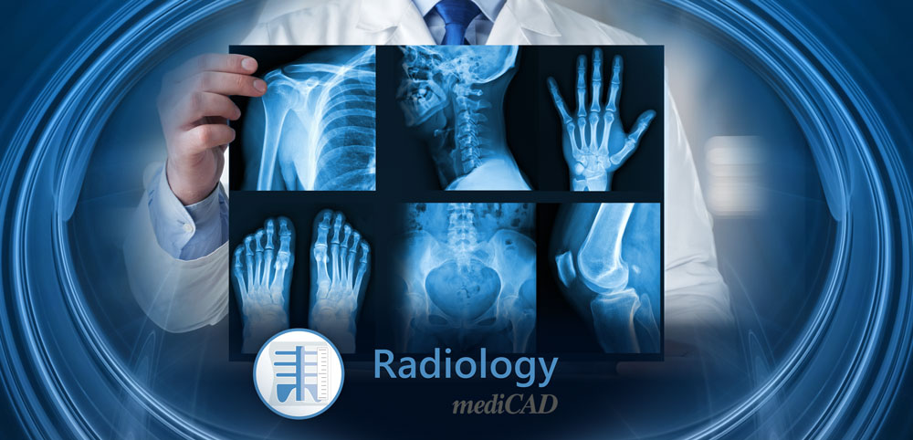 mediCAD radiology 2D - module for orthopaedic measurements